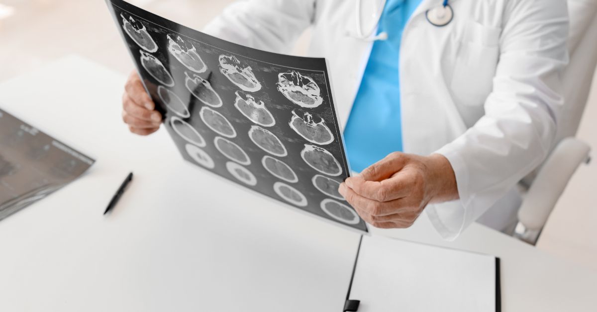 Doctor looking at brain scans