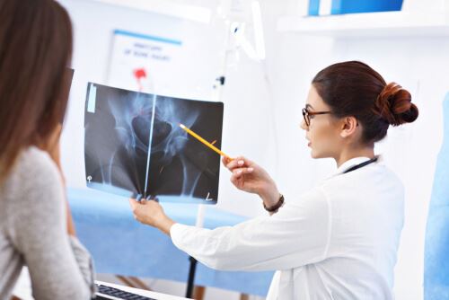 Doctor Pointing Out Something On an X-Ray With a Pencil to a Young Girl